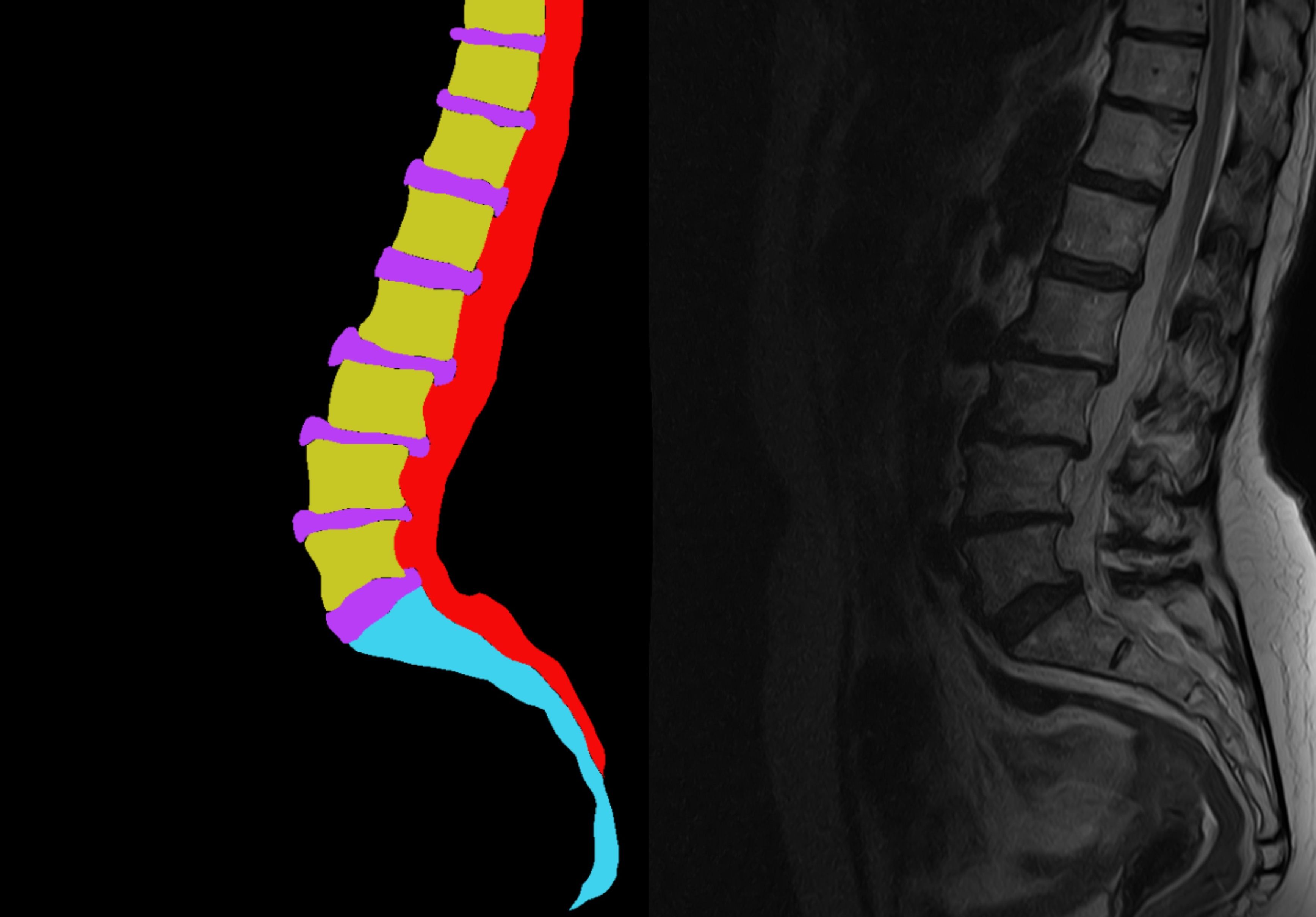 Как разметить 500 000 МРТ-снимков.jpg