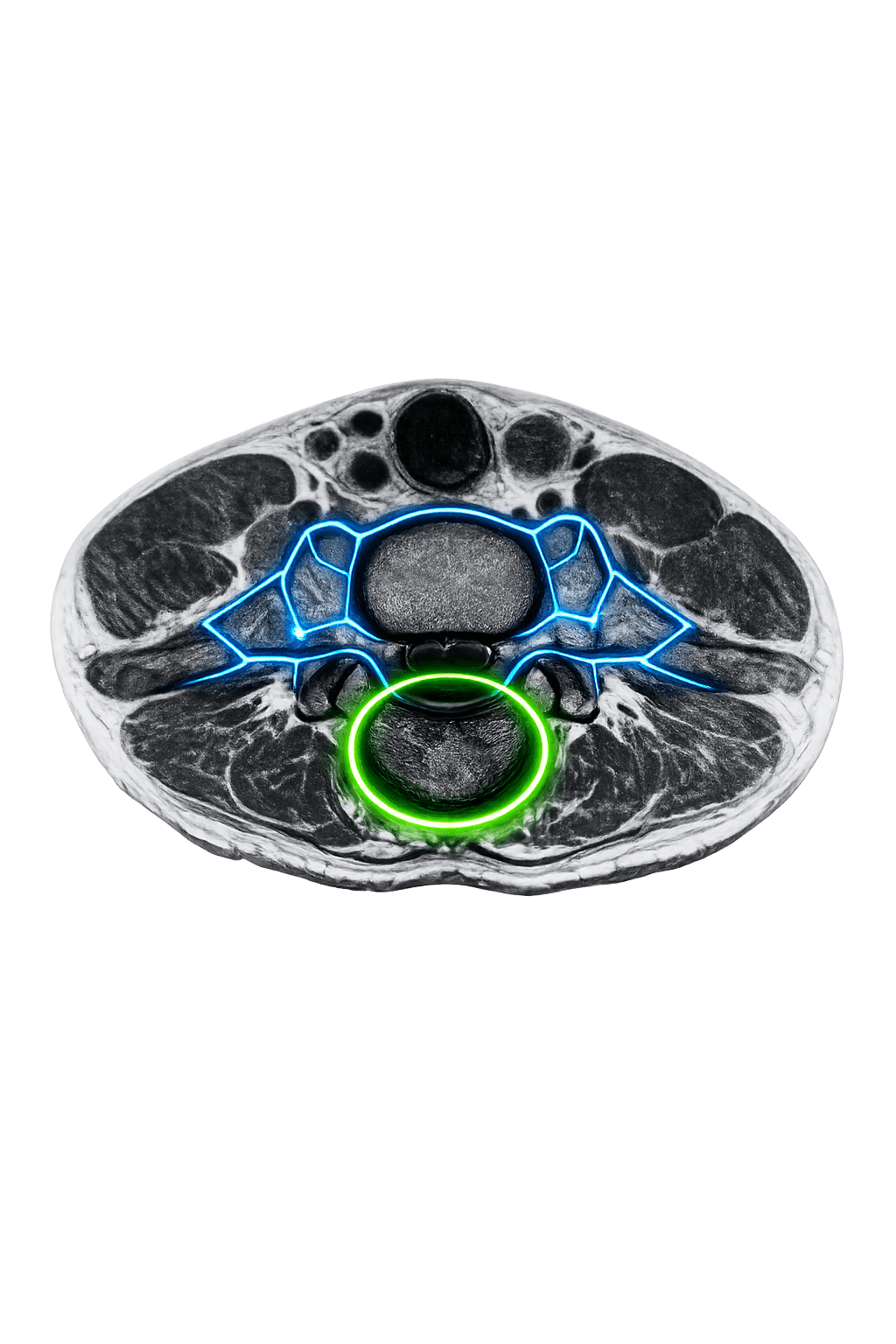 medical-mri-dataset-for-ai.png