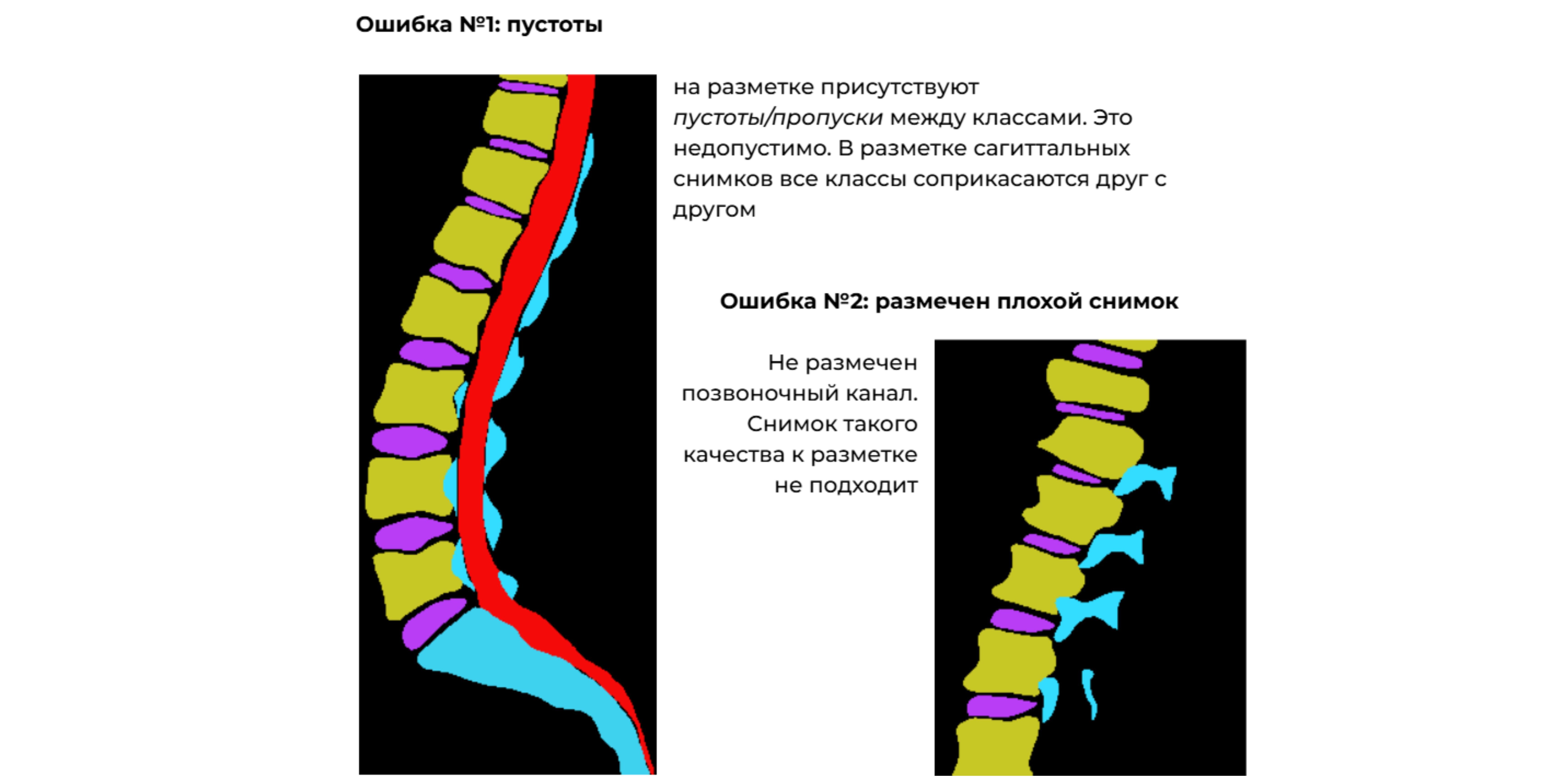 разметка рентген снимков для обучения ИИ.jpg